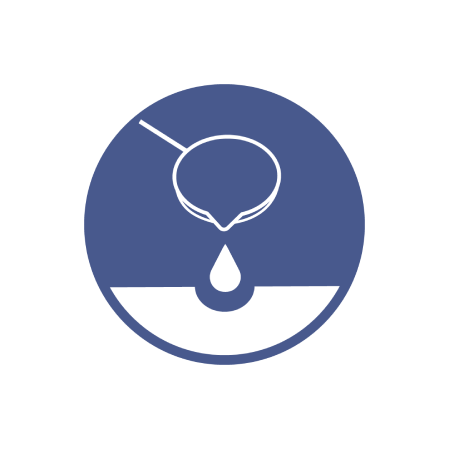 Aluminium Casting icon